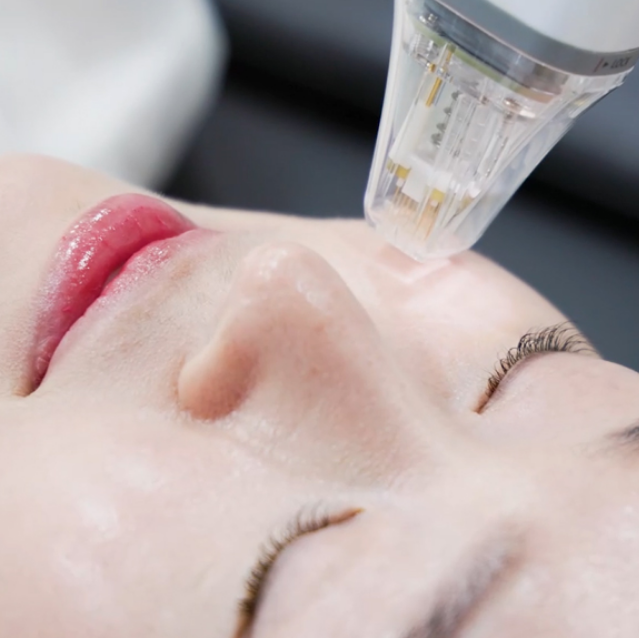 韓國 Mellow 皮膚科注射療法的真實評價：江南清潭醫院 1.5% 精英醫生的親診體驗缩略图