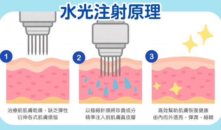 2026年韓國性價比高的水光針美容項目推薦｜首爾8家醫院實際體驗報告、價格對比及預防陷阱攻略缩略图