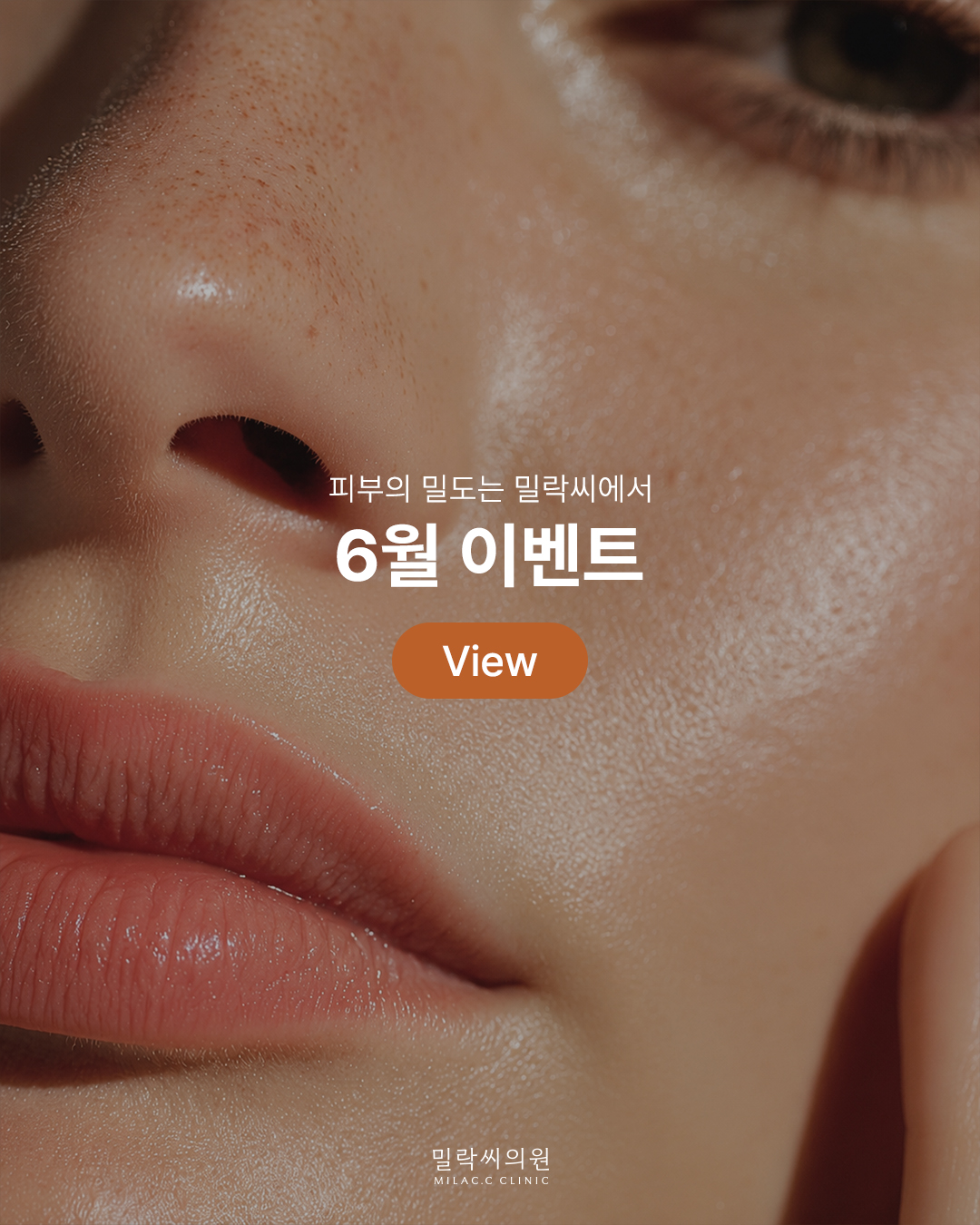 미래히 milac 피부과 6월 이벤트 홍보 이미지