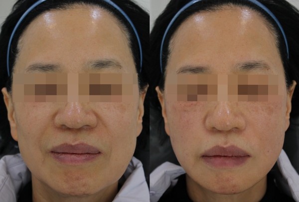 Planew韓國江南皮膚科院內設施圖