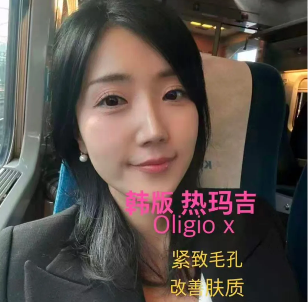 청담 에끌라드 피부과 써마지의 효과