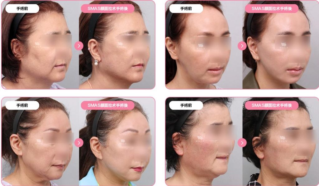 去明洞Muly皮膚科避坑指南:韓國本地人真的會去嗎?揭秘那些不為人知的細節插图1 去明洞Muly皮膚科避坑指南:韓國本地人真的會去嗎?揭秘那些不為人知的細節插图1