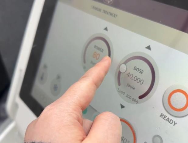 明洞Ruby皮膚科熱瑪吉治療