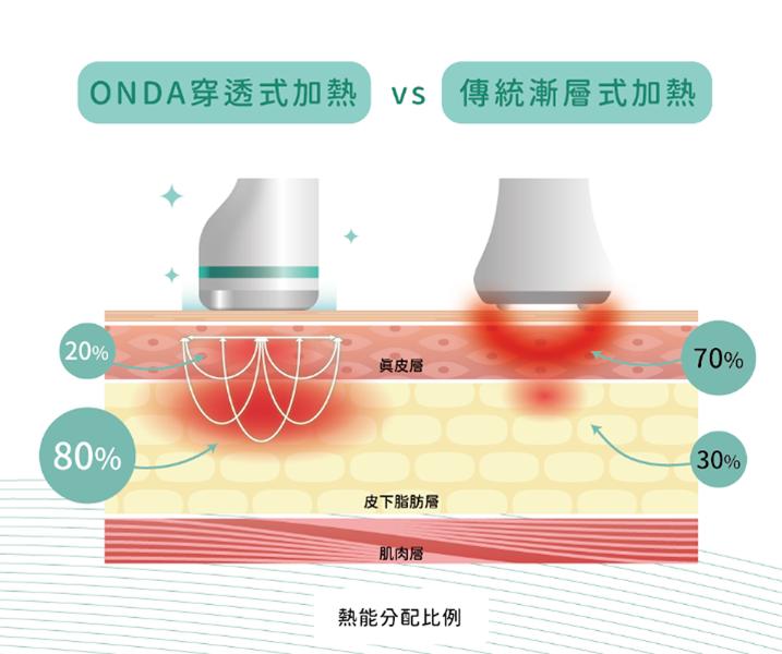 ONDA超微波與傳統漸層式加熱方式的對比