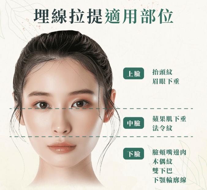 韓國埋線提拉多少錢2026?首爾線雕推薦+V臉效果真實體驗分享插图 韓國埋線提拉