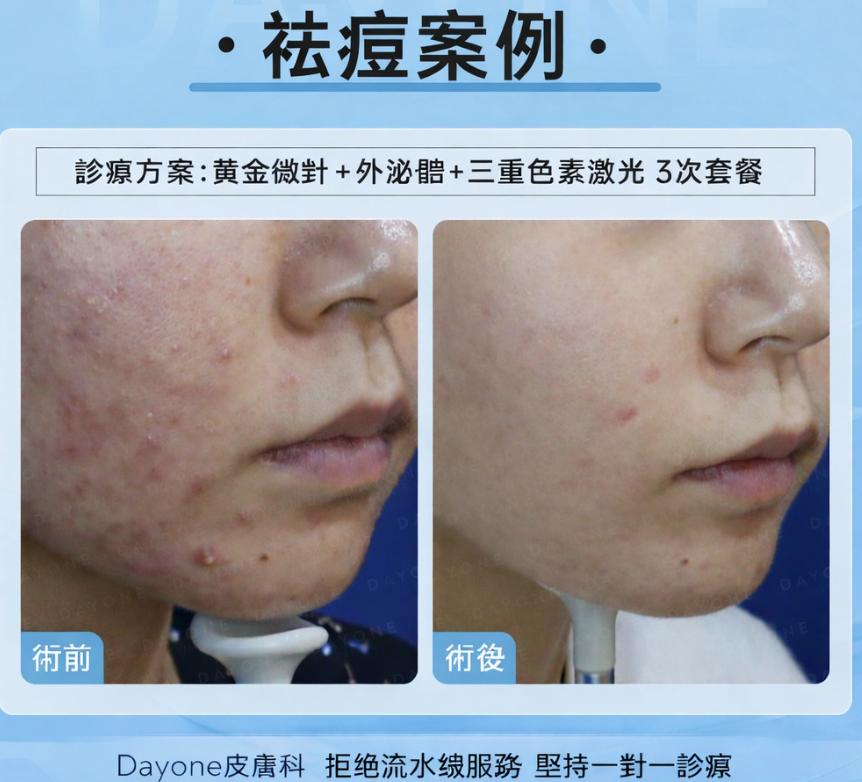 韓國 DayOne 皮膚科分店地址｜江南站、弘大、明洞各分店的詳細位置一覽缩略图