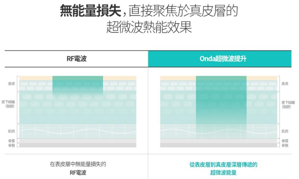 韓國Onda提升哪家好？2026年10家醫院真實推薦｜丹雅、鹿美人、罗薇全比較插图3