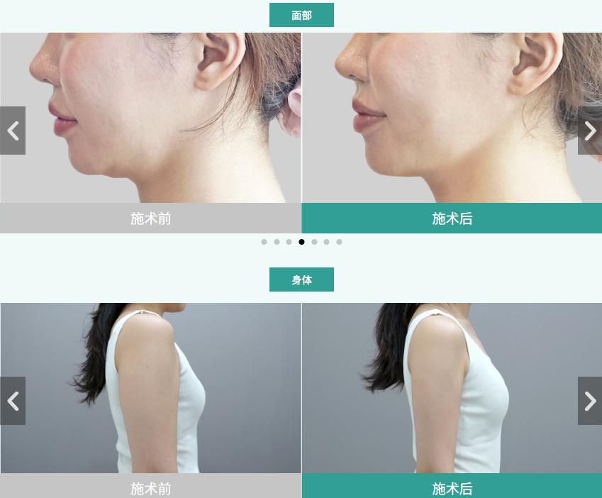 韓國Onda提升哪家好？2026年10家醫院真實推薦｜丹雅、鹿美人、罗薇全比較缩略图