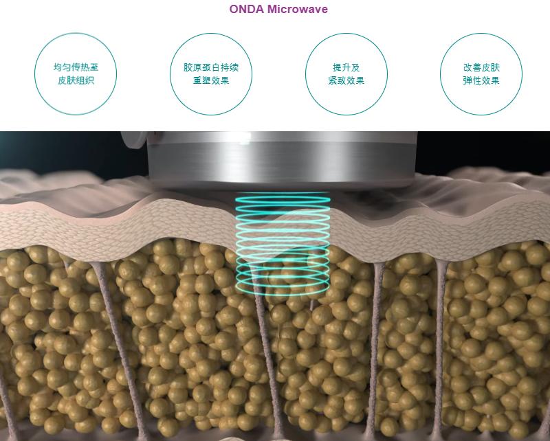 韓國Onda提升分析