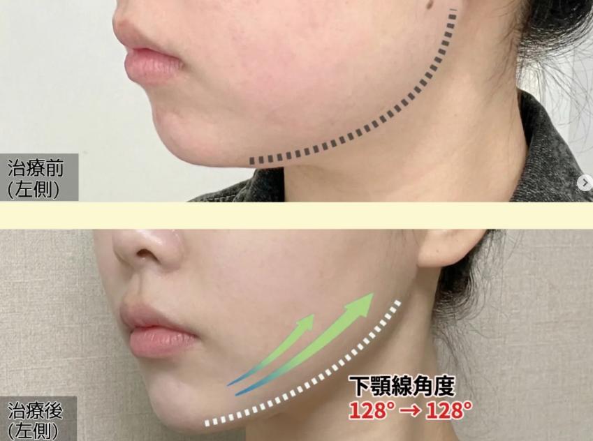 釜山Barog皮膚科價格表｜2026年最新收費指南與院長親診制度全解析缩略图