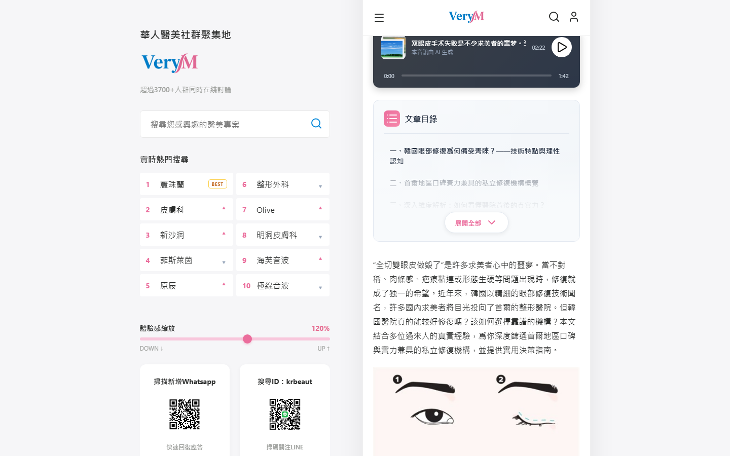 韓國切開法眼修復術後恢復期示意