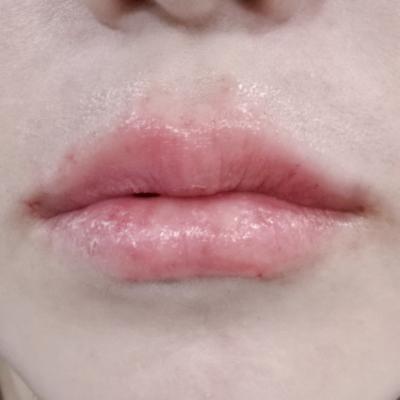 Transparency in the Pricing of Rejuran Treatments