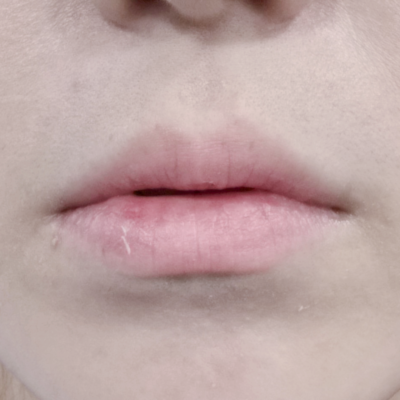 The Complete Price List at The Ippo Dermatology Clinic – Fully Transparent and Public