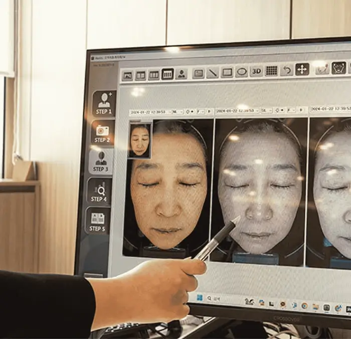 韓國皮膚科個性化諮詢服務