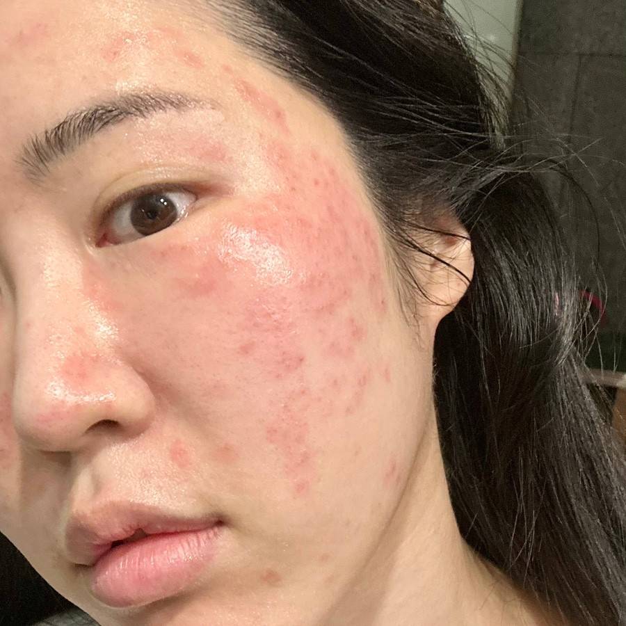 Keadaan Lingkungan Tempat Pelaksanaan Program Laser di Klinik Kulit Theia, Gangnam, Seoul