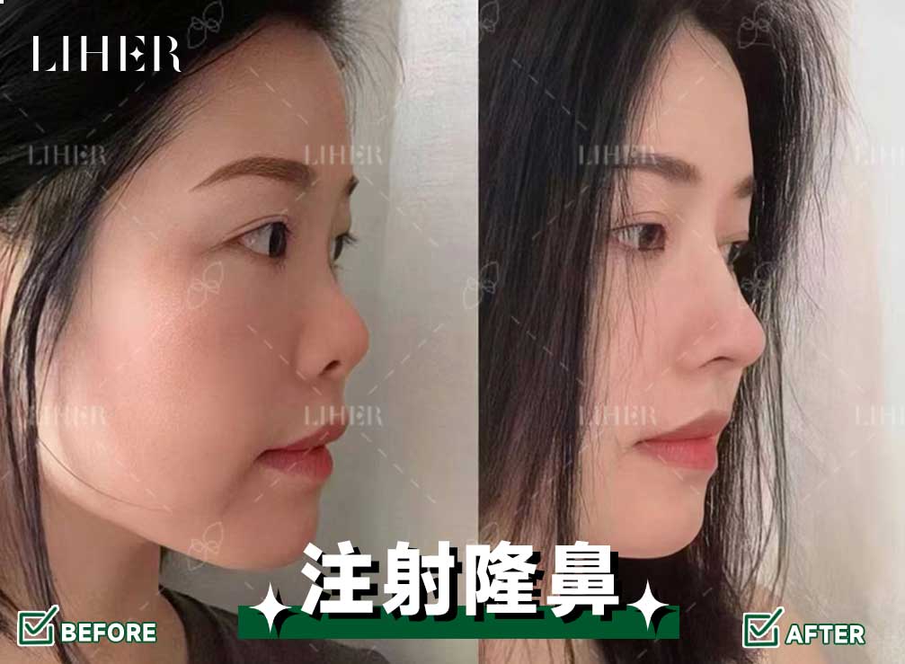 首爾江南皮膚科外國人就診攻略