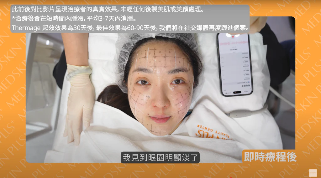 韓國首爾皮膚科熱瑪吉設備認證正版辨別