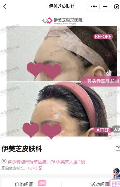 伊美芝皮膚科案例