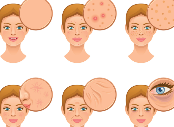 比起國內,普通人去韓國do臉真的更划算嗎?幫大家算了一筆帳(含退稅攻略)插图2 韓國做醫美