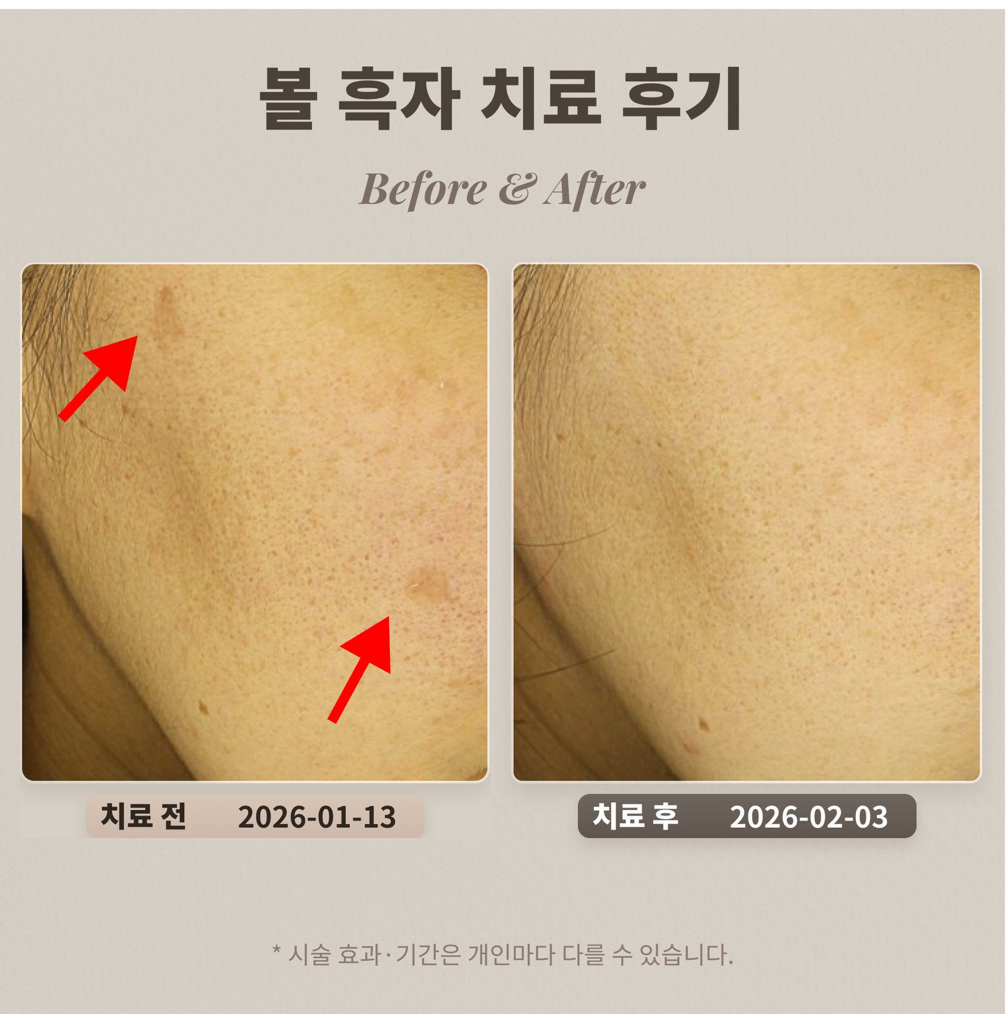 使用手機在 BeautsGO 預約鹿美人皮膚科步驟示意