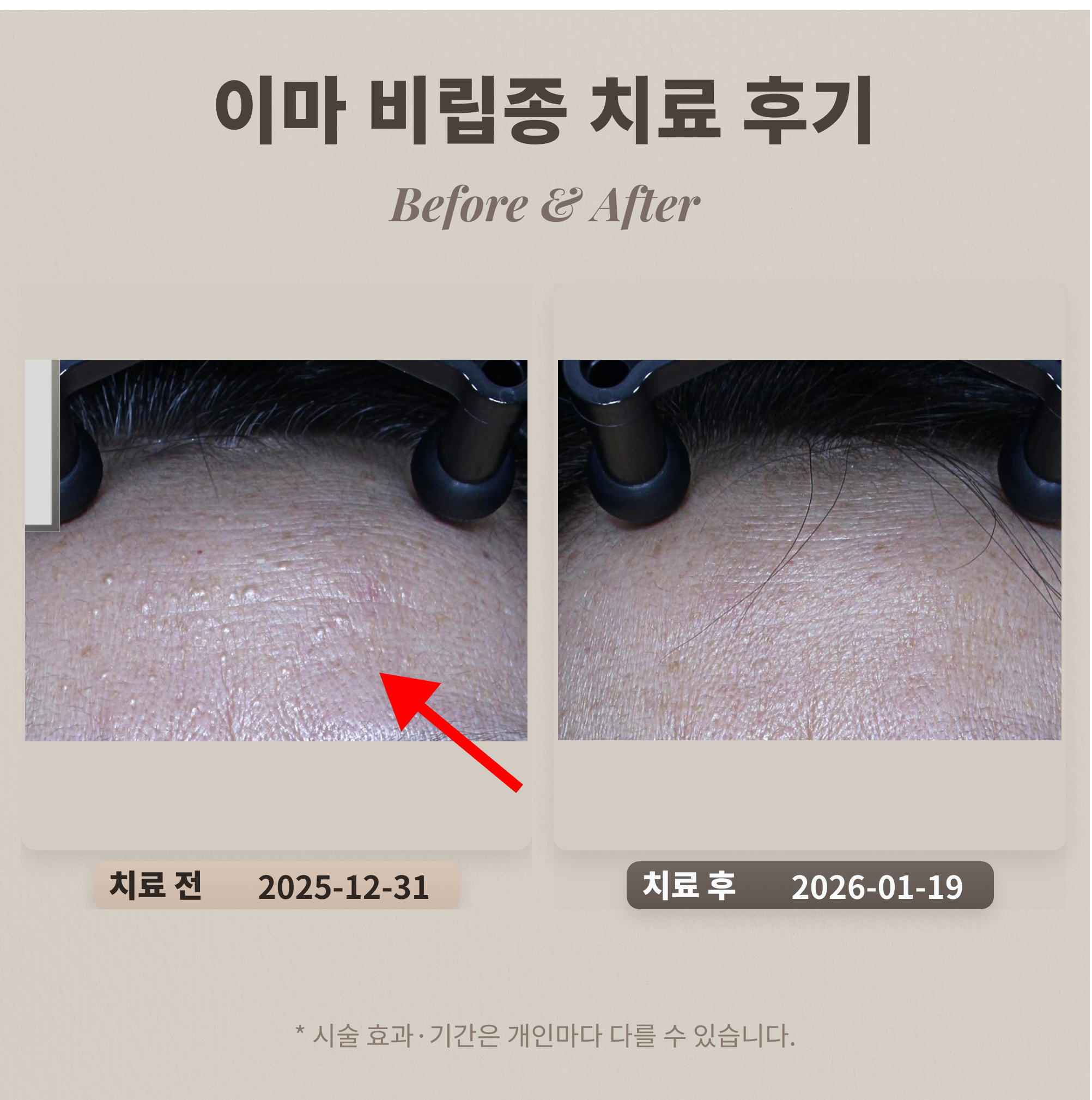 鹿美人皮膚科 Lumiin 診所候診室環境溫馨整潔