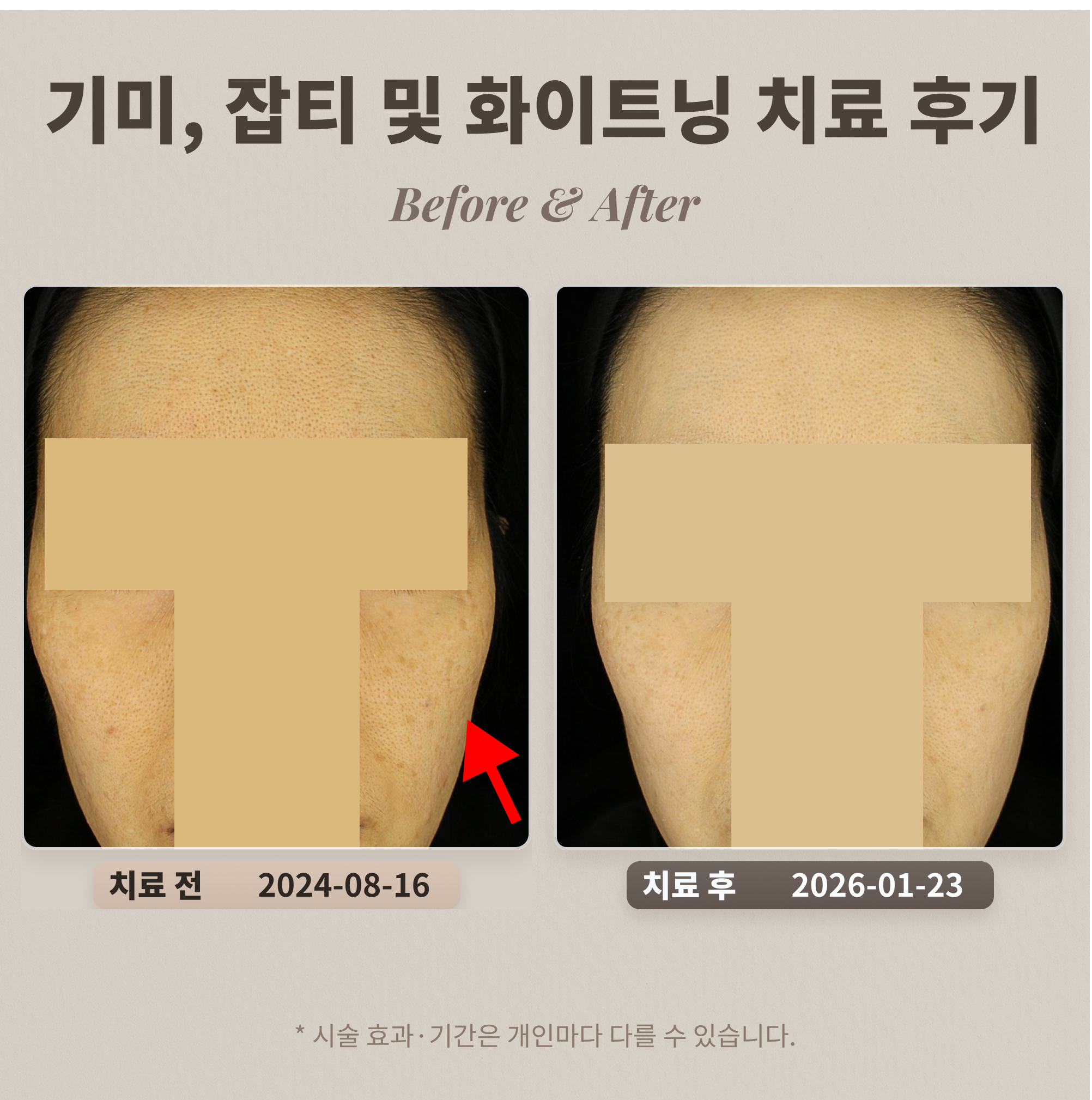 鹿美人皮膚科醫師診療情況 Lumiin 皮膚科専門醫