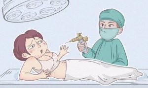 GV CLINIC 兩位院長有多強