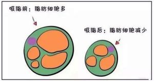 GV CLINIC 熱門項目解析
