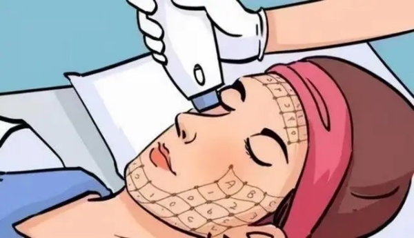 How Much Does a Full-Face Thermage Cost? 2026 Real Fees + Avoidance Guide缩略图