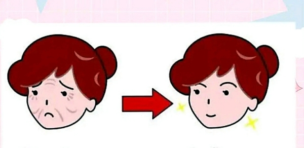 How Much Does a Full-Face Thermage Cost? 2026 Real Fees + Avoidance Guide插图1