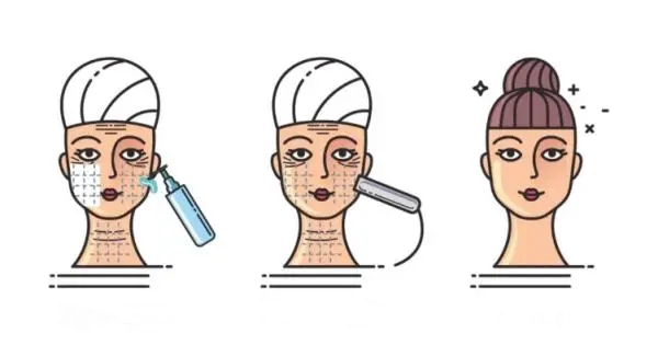 How Much Does a Full-Face Thermage Cost? 2026 Real Fees + Avoidance Guide插图2