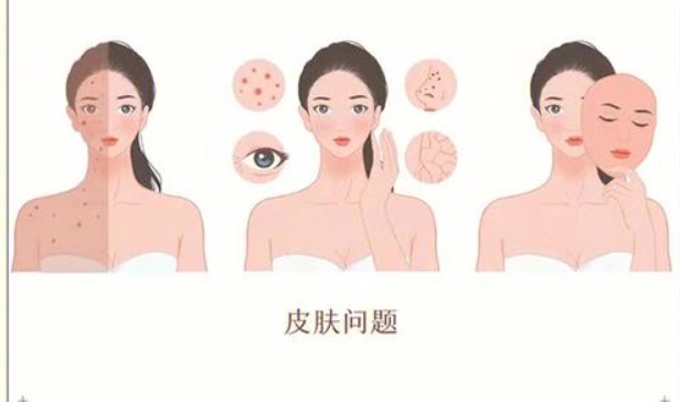 在濟州島4ever皮膚科做黃金微針是種什麼體驗?價格透明、醫生一對一,濟州島醫美首選插图1 黃金微針