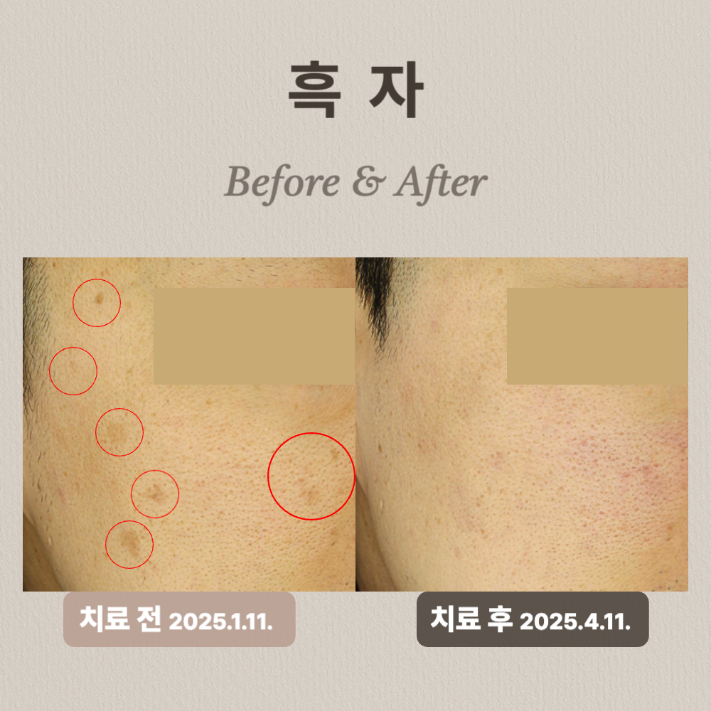 鹿美人Lumiin皮膚科醫療設備