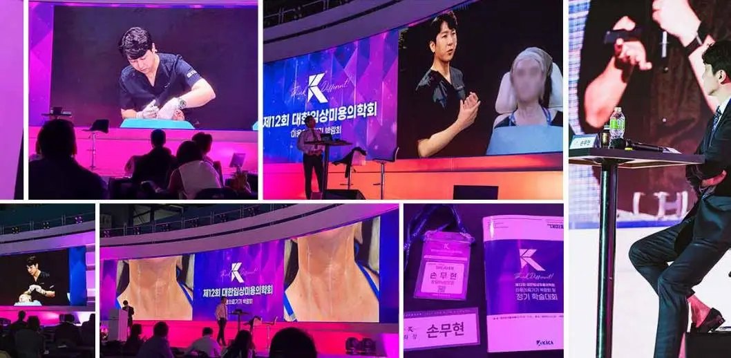 학회 현장에서 원장이 직접 장비를 활용한 시술 시연을 진행