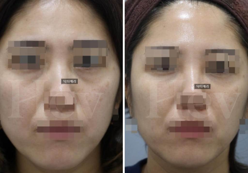 Hév 皮膚科 護理區/等候區環境