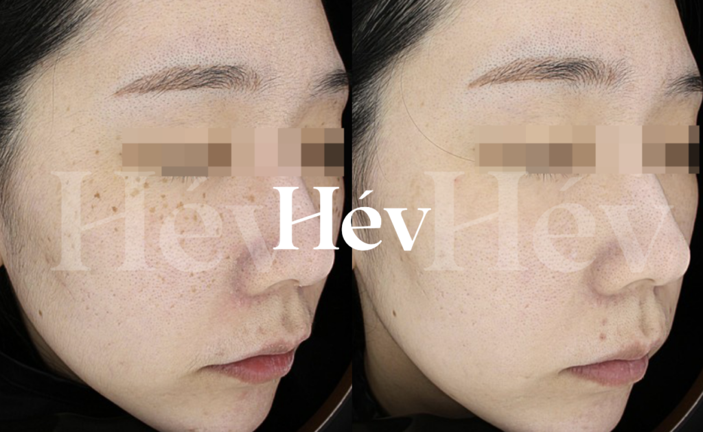 Hév 皮膚科 診所內部環境