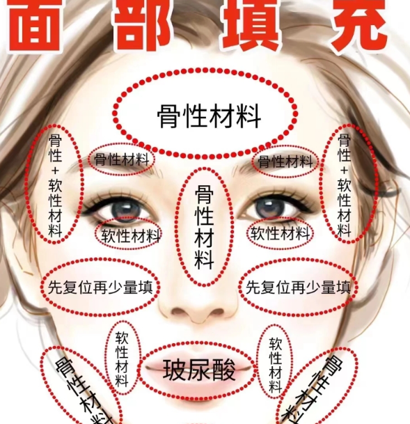 韓國弘大KATE凱特皮膚科價格表大公開!美版超聲刀108w起?玻尿酸、水光針真實報價,拒絕隱形消費!插图3 韓國弘大KATE凱特皮膚科注射填充價格