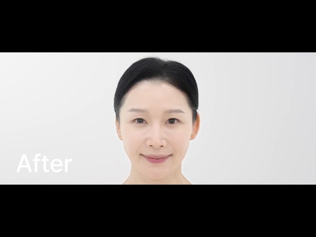 로렐 피부과의 내부 모습