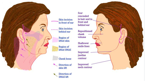 清潭美樂皮膚科:中高端皮膚管理首選,熱瑪吉・超聲刀・光子嫩膚,獨立私密診療環境插图1 清潭美樂皮膚科熱瑪吉療程