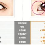 韓國EVE鄭潤載眼修復怎麼樣？技術評測、費用與真實案例深度解析缩略图