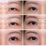 【亞洲眼王】曹仁昌雙眼皮修復案例深度解析：40年傳奇修復技術完整公開缩略图