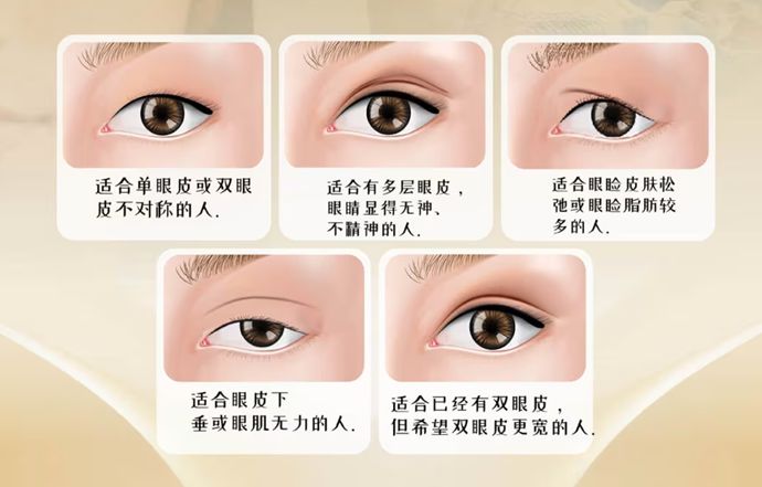 韓國十大雙眼皮手術醫生排行榜｜2026年最新評選，十位頂級名醫深度解析