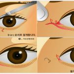 韓國EVE鄭潤載眼修復技術如何？顯微精準修復＋每日限量手術，解析眼修復領域頂尖院長的五大技術優勢缩略图