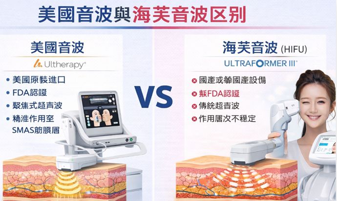 【2026最新】美國音波與海芙音波的區別完整解析：療效、價格、適合族群一次看懂