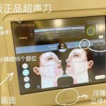 韓國do臉超聲刀價格表：韓版1.5-2萬，美版2-3萬，2026官方報價+含稅明細全公開缩略图