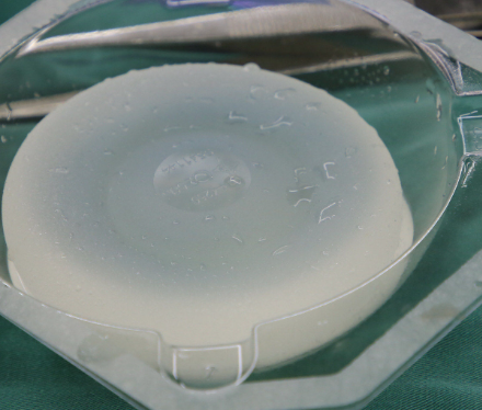 隆胸假體選擇建議,魔滴與曼托適合人群對比