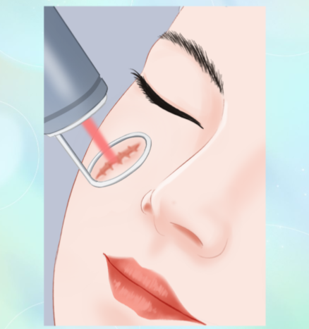 韓國醫美診所雷射設備