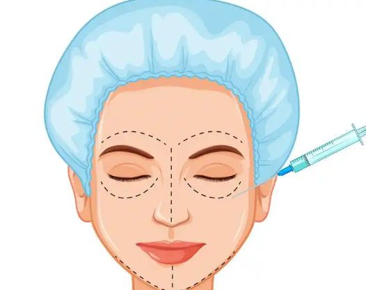Comparison of Filler and Other Materials Used in South Korea’s DO Face Procedures