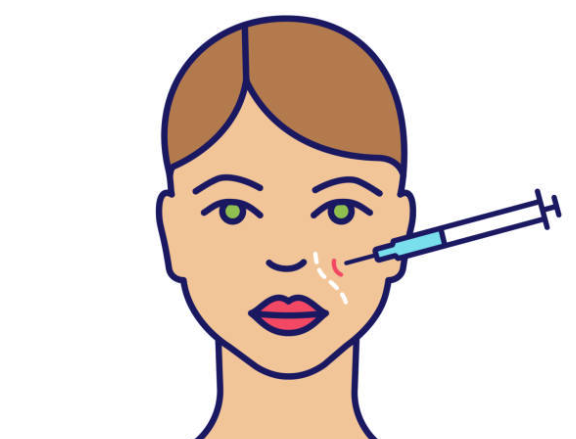 Results of South Korea’s DO Face Procedures Using Filler
