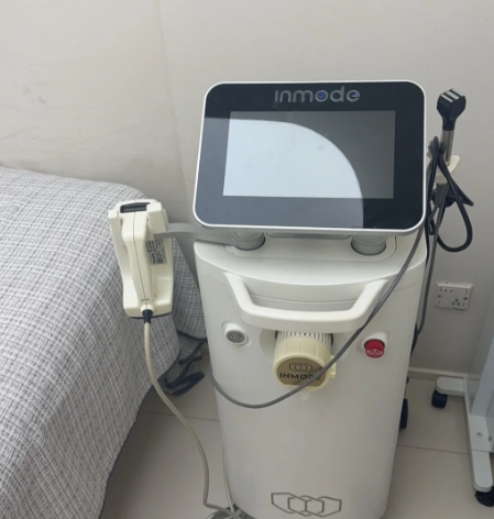 韓國InMode前後對比